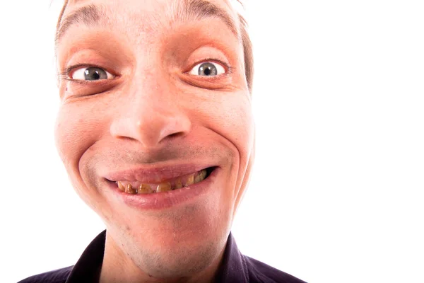les dents d'un homme très laid